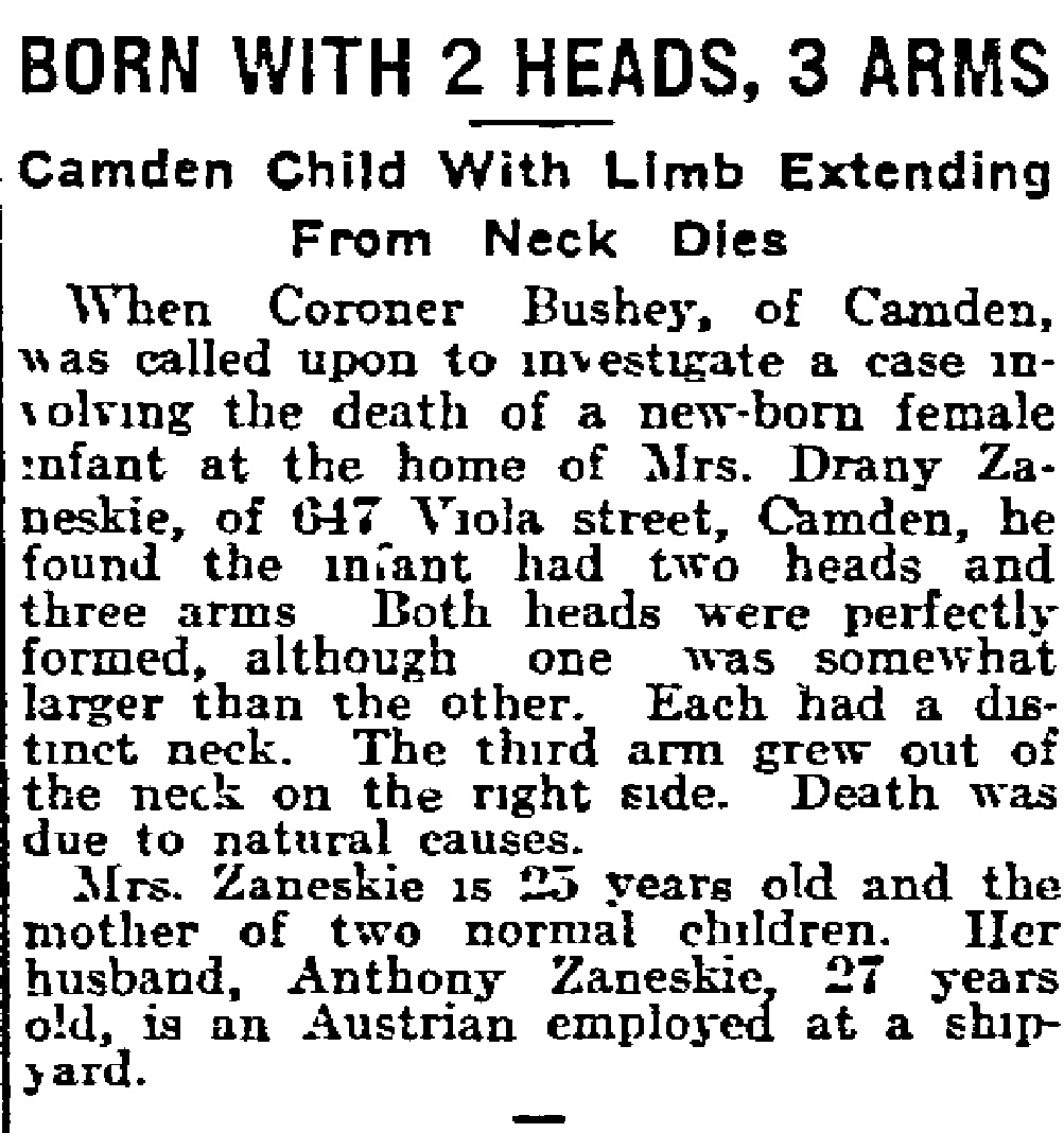 Born With 2 Heads, 3 Arms — Philadelphia Inquirer, November 9, 1915